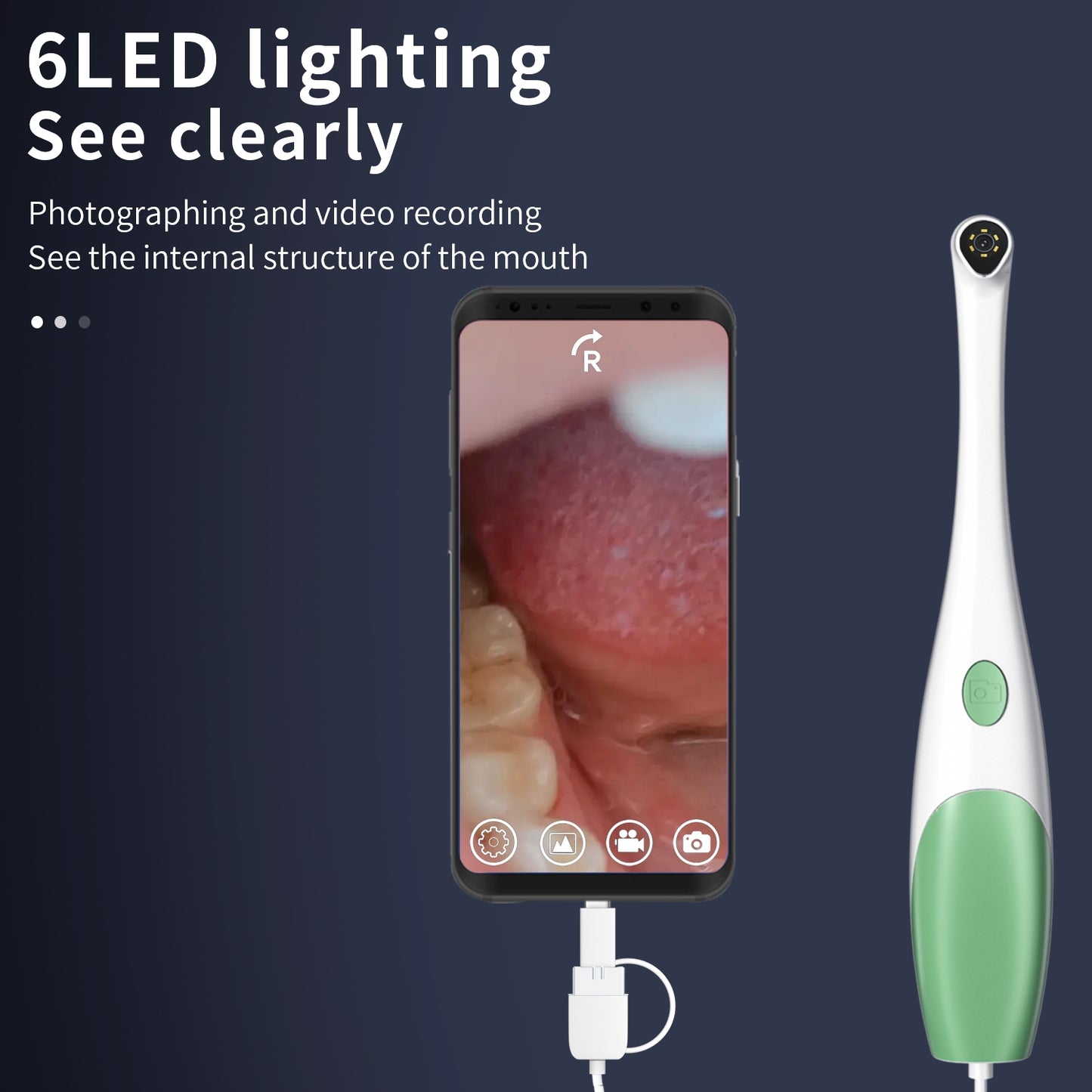 Wired dental intraoral camera connected to an Android phone for imaging
