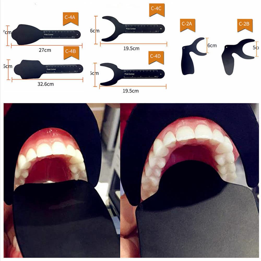 Gold Cura Intraoral Photography Contrastors | Black Background Boards Set of 6 for Dental Clinics – product image 3
